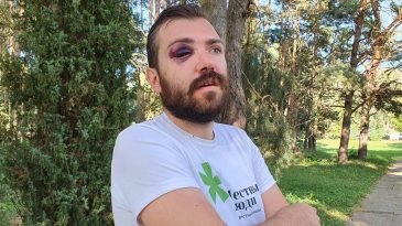 «Я стал кричать от боли. Он прекратил»: брестчанин, задержанный во время акции протеста, о том, как попал в больницу