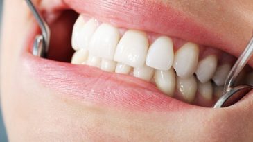 Беларуские власти точат зубы на стоматологов, а расплачиваться придется пациентам