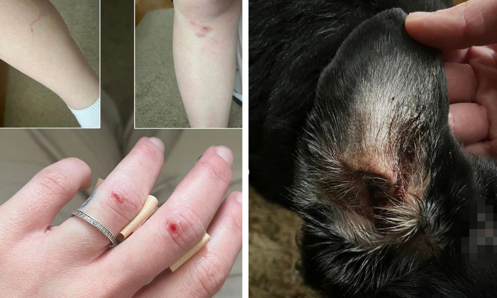 Последствия укуса большого пса для брестчанки и ее собаки. Фото: Instagram.