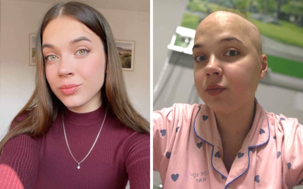 Даша Соболева мужественно борется с болезнью. Коллаж BGmedia